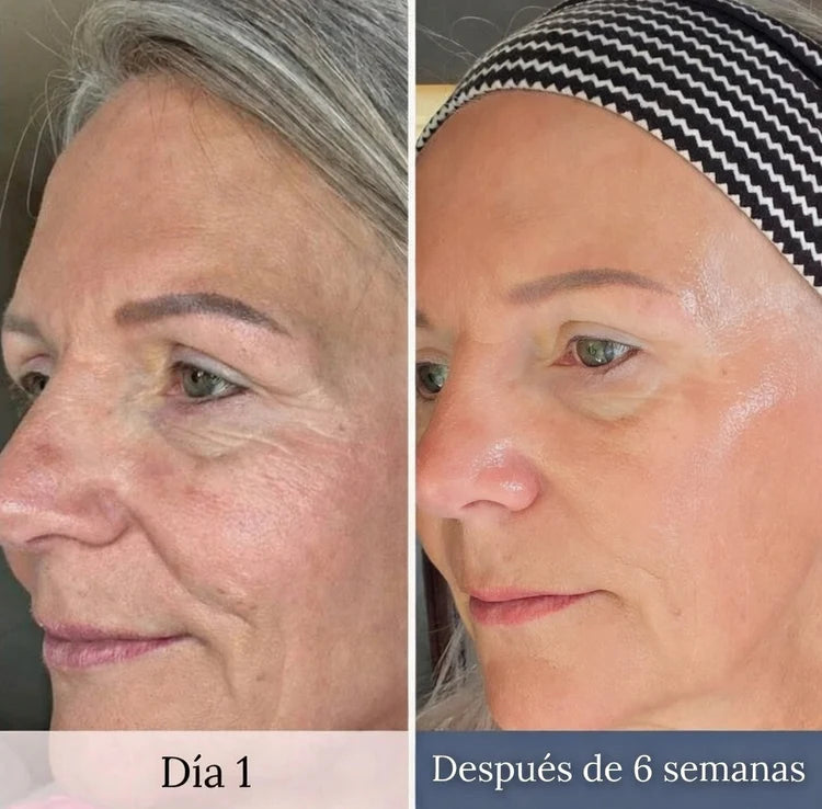 Piel más firme y cuello definido sin agujas ni dolor - LumiLift Pro