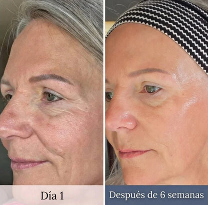 Piel más firme y cuello definido sin agujas ni dolor - LumiLift Pro